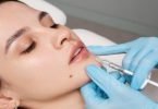 Lip Filler