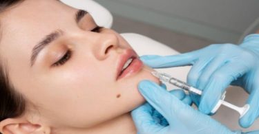 Lip Filler
