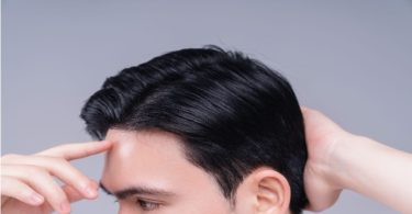 Hair Transplant Thailand Price